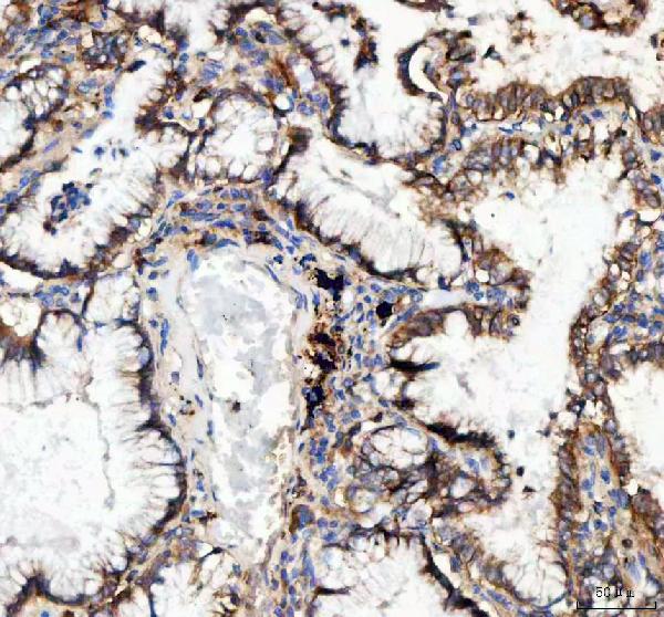 Immunohistochemistry (Formalin/PFA-fixed paraffin-embedded sections) - Anti-Integrin alpha 3 antibody (AB131055), expandable thumbnail