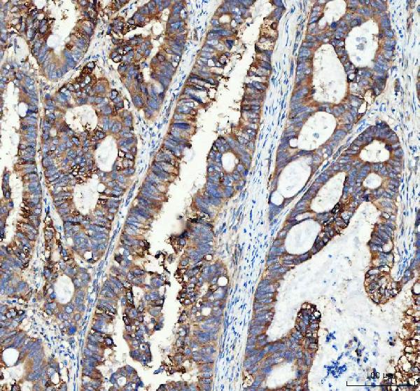 Immunohistochemistry (Formalin/PFA-fixed paraffin-embedded sections) - Anti-Integrin alpha 3 antibody (AB131055), expandable thumbnail