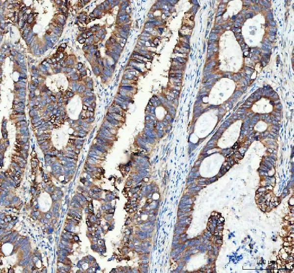 Immunohistochemistry (Formalin/PFA-fixed paraffin-embedded sections) - Anti-Integrin alpha 3 antibody (AB131055)