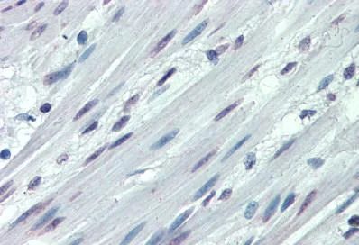 Immunohistochemistry (Formalin/PFA-fixed paraffin-embedded sections) - Anti-Integrin alpha 3 antibody (AB133198)