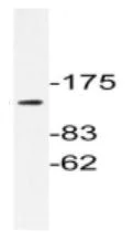 Western blot - Anti-Integrin alpha 3 antibody (AB190731)