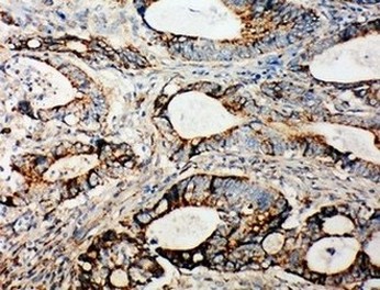 Immunohistochemistry (Formalin/PFA-fixed paraffin-embedded sections) - Anti-Integrin alpha 3 antibody - C-terminal (AB181432)