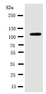 Western blot - Anti-Integrin alpha 3 antibody - C-terminal (AB181432)