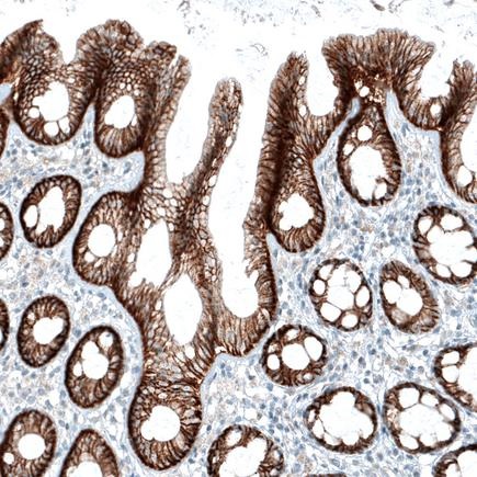 Immunohistochemistry (Formalin/PFA-fixed paraffin-embedded sections) - Anti-Integrin alpha 3 antibody [CL6937] (AB242196), expandable thumbnail