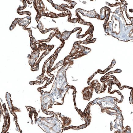 Immunohistochemistry (Formalin/PFA-fixed paraffin-embedded sections) - Anti-Integrin alpha 3 antibody [CL6937] (AB242196), expandable thumbnail