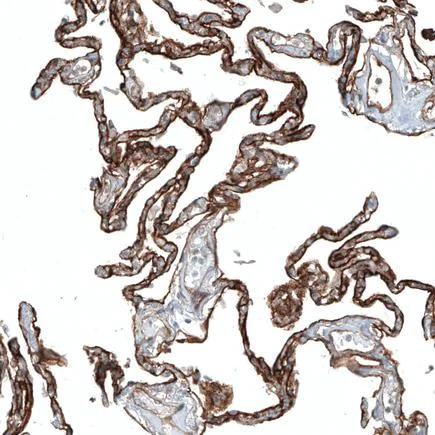 Immunohistochemistry (Formalin/PFA-fixed paraffin-embedded sections) - Anti-Integrin alpha 3 antibody [CL6937] (AB242196)