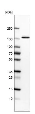 Western blot - Anti-Integrin alpha 3 antibody [CL6937] (AB242196)