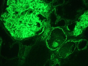 Immunohistochemistry (Frozen sections) - Anti-Integrin alpha 3a antibody [29A3] (AB8985), expandable thumbnail