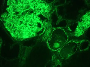 Immunohistochemistry (Frozen sections) - Anti-Integrin alpha 3a antibody [29A3] (AB8985)