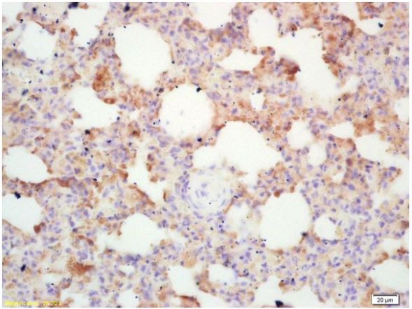 Immunohistochemistry (Formalin/PFA-fixed paraffin-embedded sections) - Anti-Integrin alpha 4/CD49D antibody (AB202969), expandable thumbnail