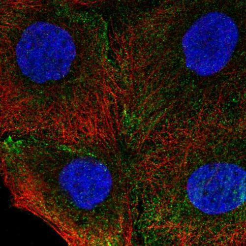 Immunocytochemistry/ Immunofluorescence - Anti-Integrin alpha 4/CD49D antibody (AB244548)
