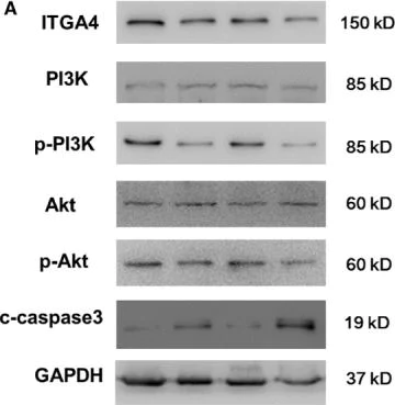 Western blot - Anti-Integrin alpha 4/CD49D antibody [EPR1355Y] (AB81280)