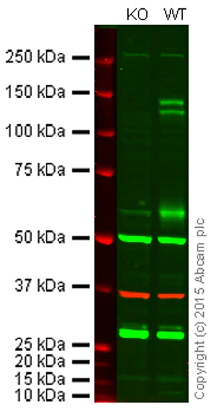 Western blot - Anti-Integrin alpha 4/CD49D antibody [EPR1355Y] - BSA and Azide free (AB239898)