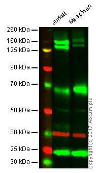 Western blot - Anti-Integrin alpha 4/CD49D antibody [EPR1355Y] - BSA and Azide free (AB239898)