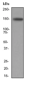 Western blot - Anti-Integrin alpha 4/CD49D antibody [EPR1355Y] - BSA and Azide free (AB239898)