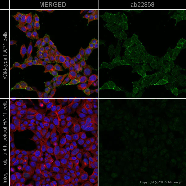 Immunocytochemistry/ Immunofluorescence - Anti-Integrin alpha 4/CD49D antibody [HP2/1] (AB22858)