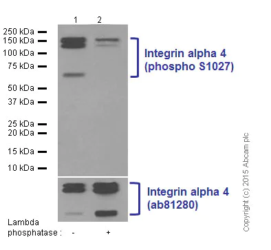 Western blot - Anti-Integrin alpha 4/CD49D (phospho S988) antibody [EPR2343] (AB75760)