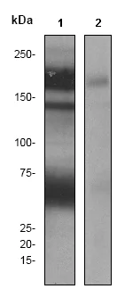 Western blot - Anti-Integrin alpha 4/CD49D (phospho S988) antibody [EPR2343] - BSA and Azide free (AB247393)