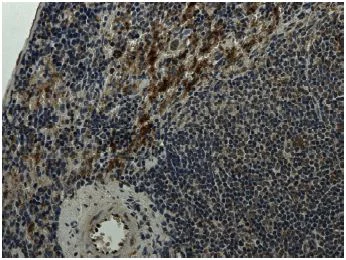 Immunohistochemistry (Formalin/PFA-fixed paraffin-embedded sections) - Anti-Integrin alpha 4+beta 7 antibody [RM0059-2G18] (AB73261)