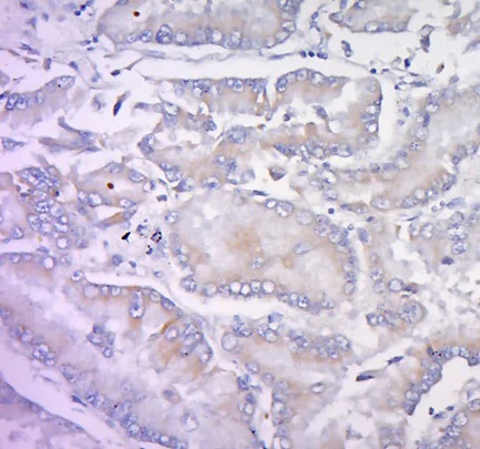 Immunohistochemistry (Formalin/PFA-fixed paraffin-embedded sections) - Anti-Integrin alpha 5 antibody (AB203029)