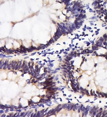 Immunohistochemistry (Formalin/PFA-fixed paraffin-embedded sections) - Anti-Integrin alpha 5 antibody (AB203029)