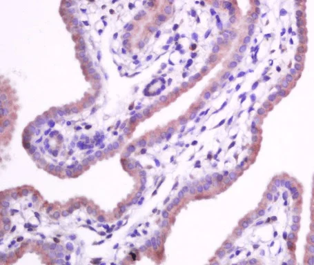 Immunohistochemistry (Formalin/PFA-fixed paraffin-embedded sections) - Anti-Integrin alpha 5 antibody (AB203029)
