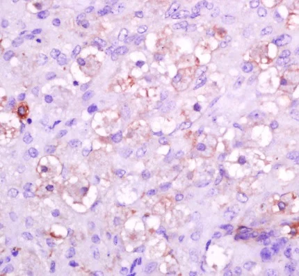 Immunohistochemistry (Formalin/PFA-fixed paraffin-embedded sections) - Anti-Integrin alpha 5 antibody (AB203029)