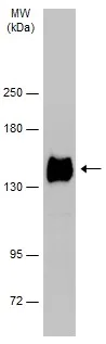Western blot - Anti-Integrin alpha 5 antibody (AB226816)