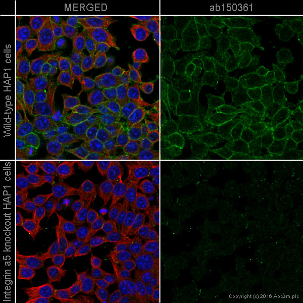 Immunocytochemistry/ Immunofluorescence - Anti-Integrin alpha 5 antibody [EPR7854] - BSA and Azide free (ab239400), expandable thumbnail