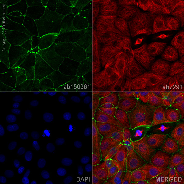 Immunocytochemistry/ Immunofluorescence - Anti-Integrin alpha 5 antibody [EPR7854] - BSA and Azide free (ab239400), expandable thumbnail