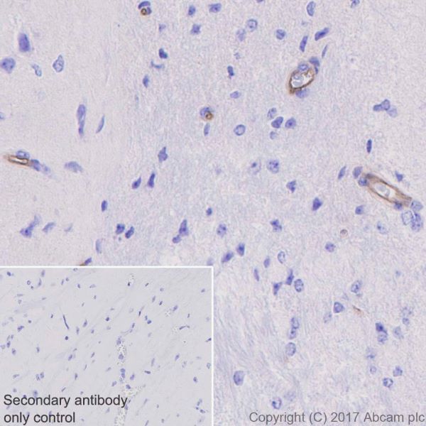 Immunohistochemistry (Formalin/PFA-fixed paraffin-embedded sections) - Anti-Integrin alpha 5 antibody [EPR7854] - BSA and Azide free (ab239400), expandable thumbnail