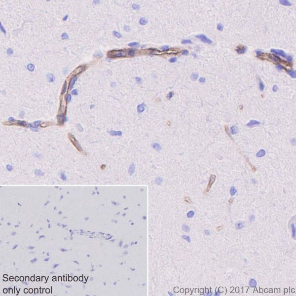 Immunohistochemistry (Formalin/PFA-fixed paraffin-embedded sections) - Anti-Integrin alpha 5 antibody [EPR7854] - BSA and Azide free (ab239400), expandable thumbnail
