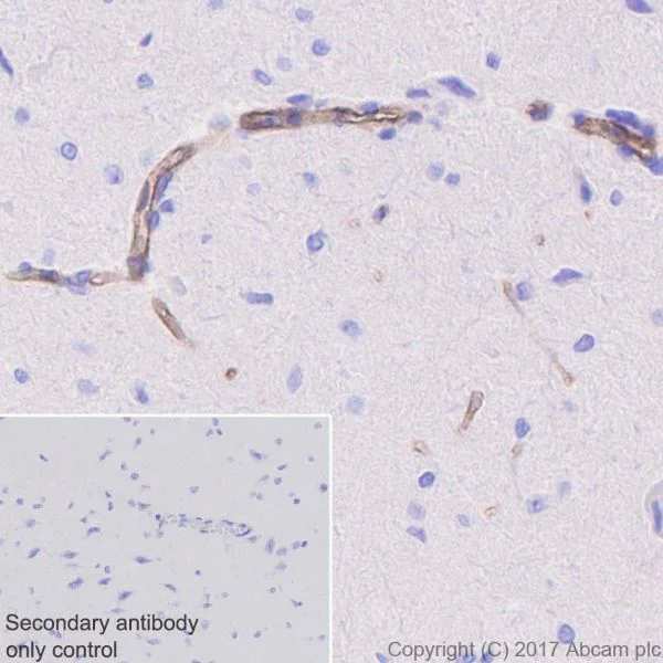 Immunohistochemistry (Formalin/PFA-fixed paraffin-embedded sections) - Anti-Integrin alpha 5 antibody [EPR7854] - BSA and Azide free (AB239400)