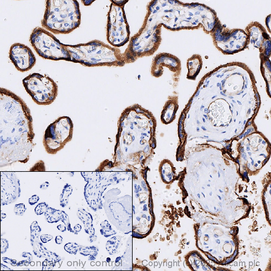 Immunohistochemistry (Formalin/PFA-fixed paraffin-embedded sections) - Anti-Integrin alpha 5 antibody [EPR7854] - BSA and Azide free (AB239400)