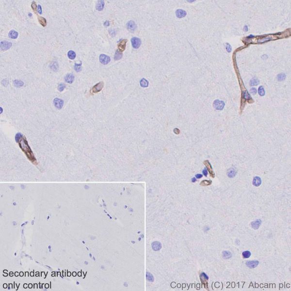 Immunohistochemistry (Formalin/PFA-fixed paraffin-embedded sections) - Anti-Integrin alpha 5 antibody [EPR7854] - BSA and Azide free (AB239400), expandable thumbnail