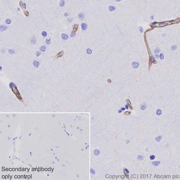 Immunohistochemistry (Formalin/PFA-fixed paraffin-embedded sections) - Anti-Integrin alpha 5 antibody [EPR7854] - BSA and Azide free (AB239400)