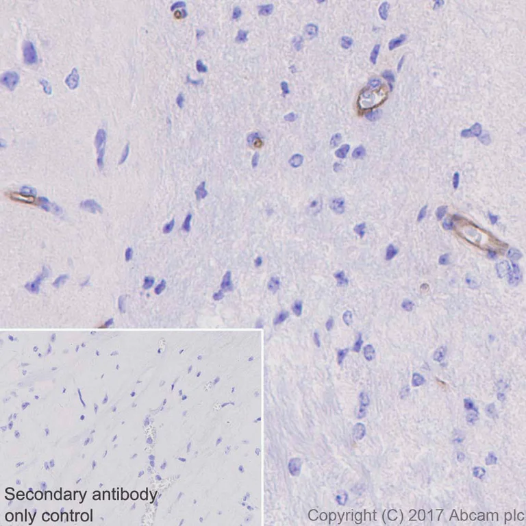 Immunohistochemistry (Formalin/PFA-fixed paraffin-embedded sections) - Anti-Integrin alpha 5 antibody [EPR7854] - Low endotoxin, Azide free (AB221606)