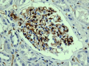 Immunohistochemistry (Formalin/PFA-fixed paraffin-embedded sections) - Anti-Integrin alpha 5 antibody [EPR7854] - Low endotoxin, Azide free (AB221606)