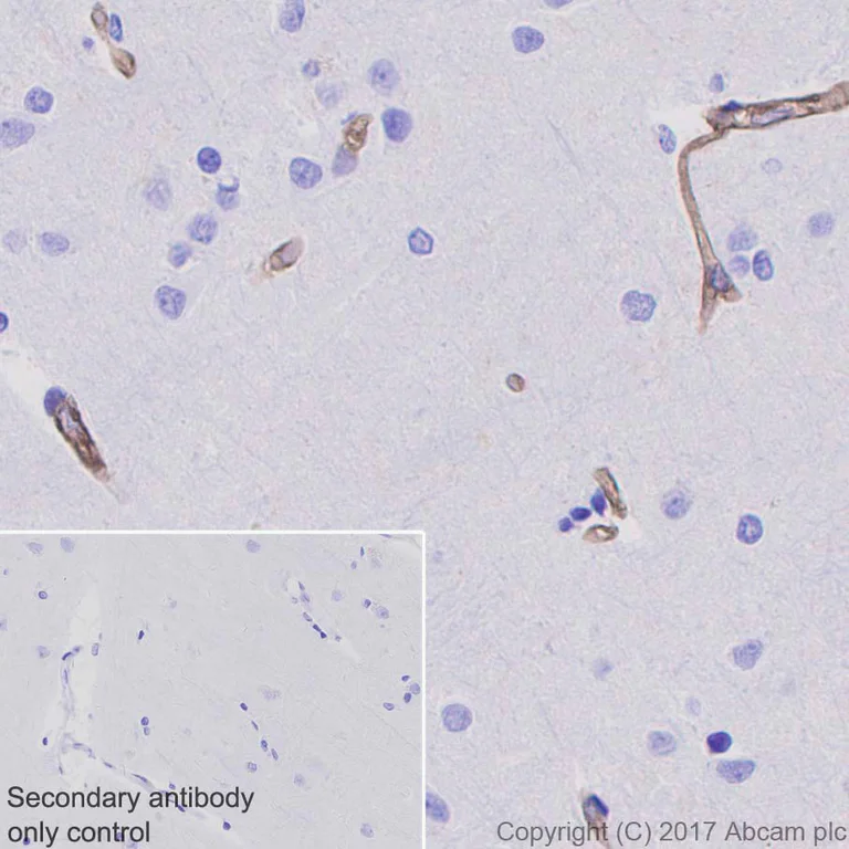 Immunohistochemistry (Formalin/PFA-fixed paraffin-embedded sections) - Anti-Integrin alpha 5 antibody [EPR7854] - Low endotoxin, Azide free (AB221606)