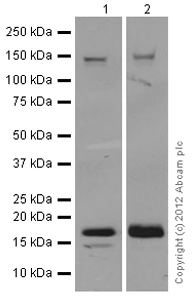 Western blot - Anti-Integrin alpha 5 antibody [EPR7854] - Low endotoxin, Azide free (AB221606)
