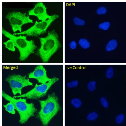Immunocytochemistry/ Immunofluorescence - Anti-Integrin alpha 5 + beta 1 antibody [M200 (Volociximab)] - Rabbit IgG (Chimeric) (AB275977)