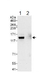Immunoprecipitation - Anti-Integrin alpha 6 antibody (AB134579), expandable thumbnail