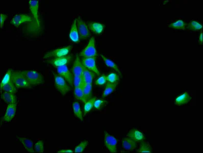 Immunocytochemistry/ Immunofluorescence - Anti-Integrin alpha 6 antibody (AB235905)