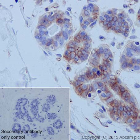 Immunohistochemistry (Formalin/PFA-fixed paraffin-embedded sections) - Anti-Integrin alpha 6 antibody [EPR18124] (AB181551)