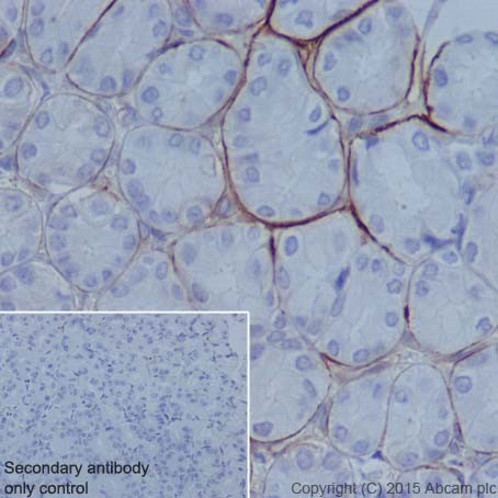 Immunohistochemistry (Formalin/PFA-fixed paraffin-embedded sections) - Anti-Integrin alpha 6 antibody [EPR18124] - BSA and Azide free (ab240252), expandable thumbnail