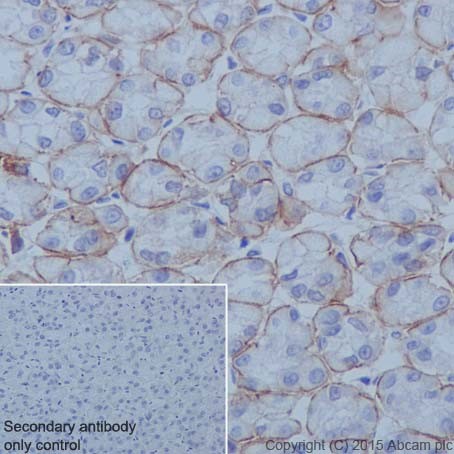 Immunohistochemistry (Formalin/PFA-fixed paraffin-embedded sections) - Anti-Integrin alpha 6 antibody [EPR18124] - BSA and Azide free (AB240252), expandable thumbnail