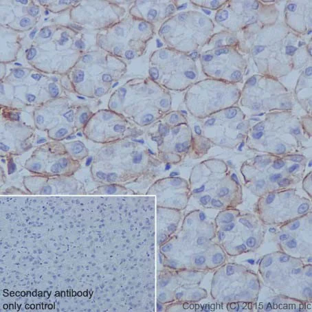 Immunohistochemistry (Formalin/PFA-fixed paraffin-embedded sections) - Anti-Integrin alpha 6 antibody [EPR18124] - BSA and Azide free (AB240252)