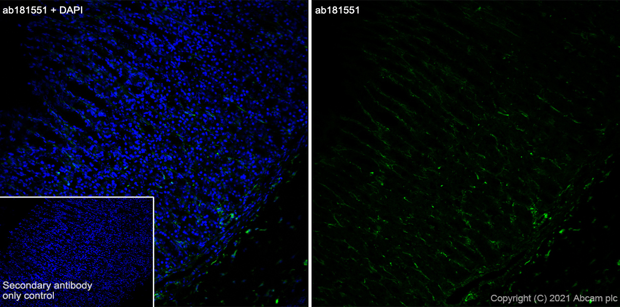 Immunohistochemistry (Frozen sections) - Anti-Integrin alpha 6 antibody [EPR18124] - BSA and Azide free (AB240252), expandable thumbnail