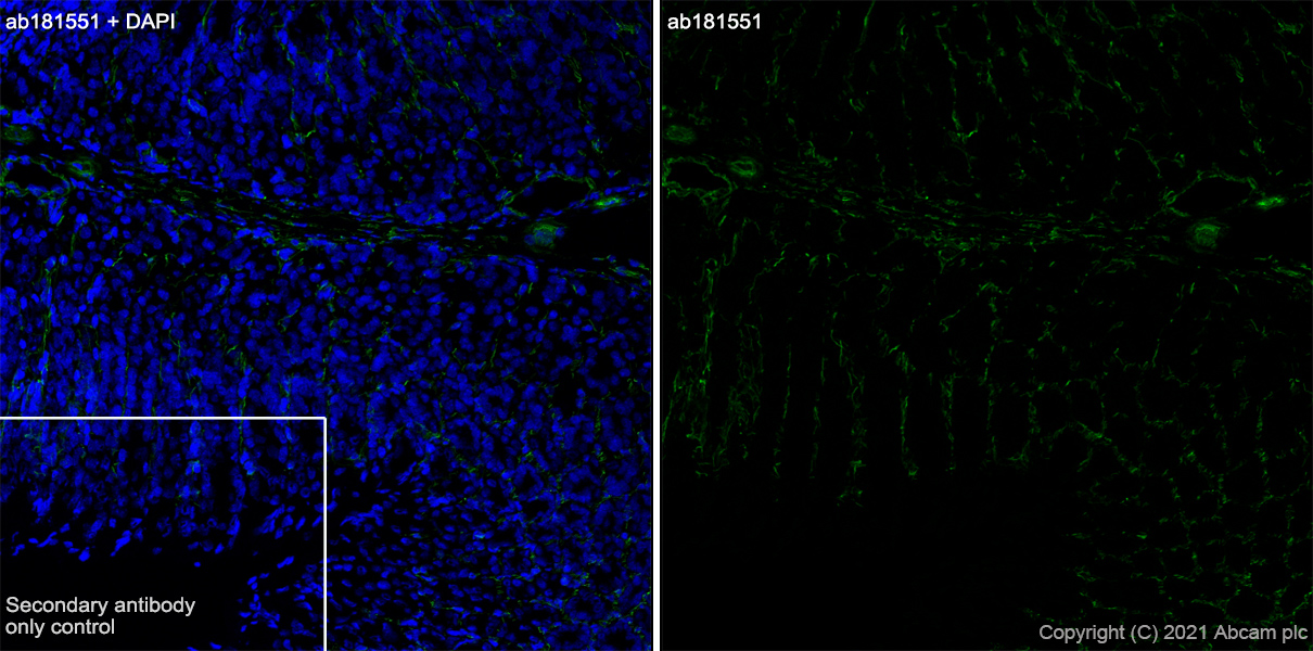 Immunohistochemistry (Frozen sections) - Anti-Integrin alpha 6 antibody [EPR18124] - BSA and Azide free (ab240252), expandable thumbnail