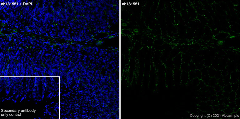 Immunohistochemistry (Frozen sections) - Anti-Integrin alpha 6 antibody [EPR18124] - BSA and Azide free (AB240252)